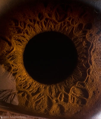 عکس ماکروی چشم انسان